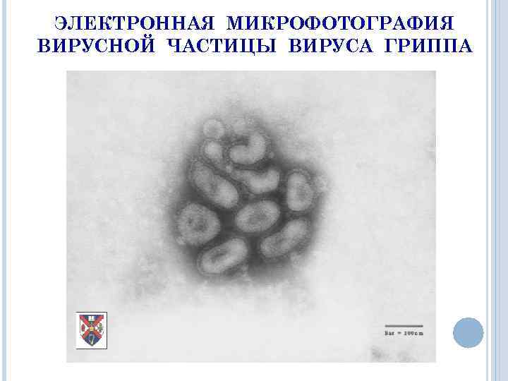 ЭЛЕКТРОННАЯ МИКРОФОТОГРАФИЯ ВИРУСНОЙ ЧАСТИЦЫ ВИРУСА ГРИППА 