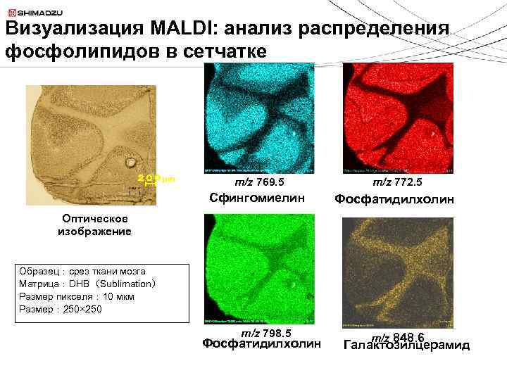 Визуализация MALDI: анализ распределения фосфолипидов в сетчатке ２００μm m/z 769. 5 Сфингомиелин m/z 772.
