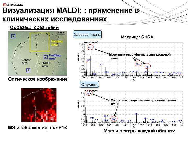Визуализация MALDI: : применение в клинических исследованиях Образец: срез ткани Здоровая ткань Матрица: CHCA