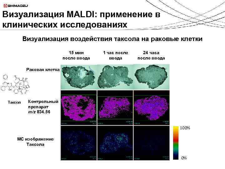 Визуализация MALDI: применение в клинических исследованиях Визуализация воздействия таксола на раковые клетки 15 мин