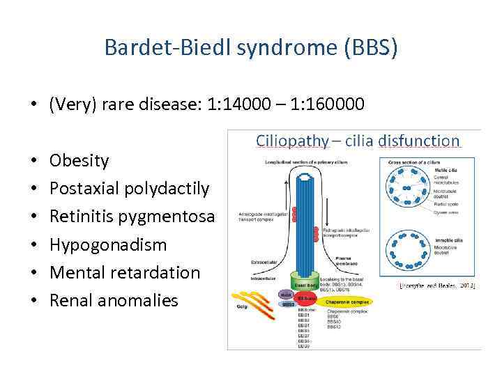 Bardet-Biedl syndrome (BBS) • (Very) rare disease: 1: 14000 – 1: 160000 • •