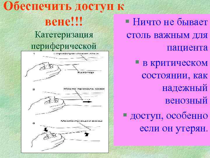 Обеспечить доступ к § Ничто не бывает вене!!! Катетеризация периферической вены столь важным для