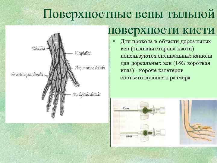 Поверхностные вены тыльной поверхности кисти § Для прокола в области дорсальных вен (тыльная сторона