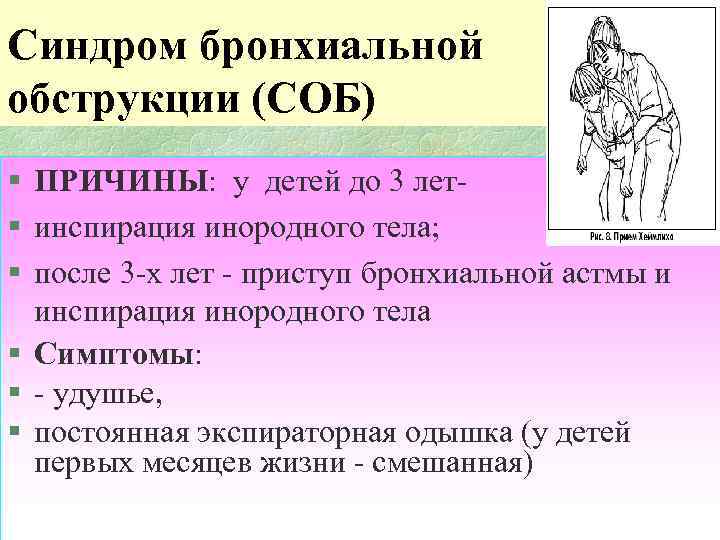 Синдром бронхиальной обструкции (СОБ) § ПРИЧИНЫ: у детей до 3 лет- § инспирация инородного