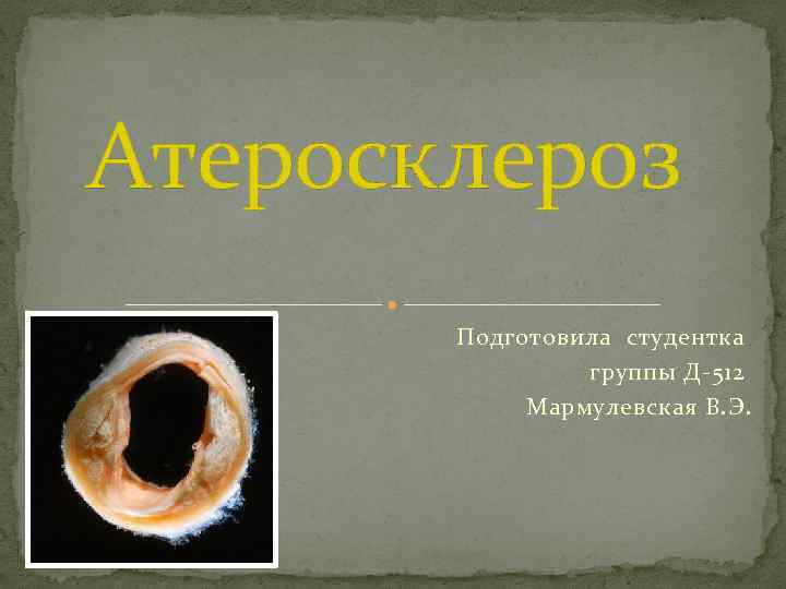 Атеросклероз Подготовила студентка группы Д-512 Мармулевская В. Э. 