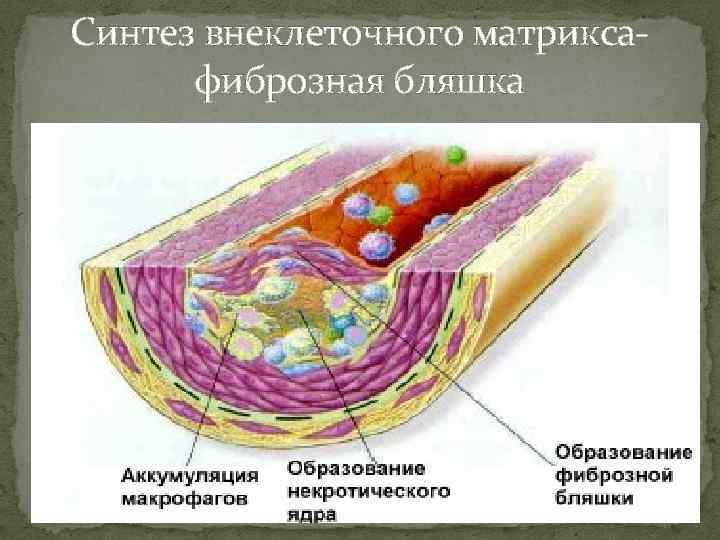 Синтез внеклеточного матриксафиброзная бляшка 