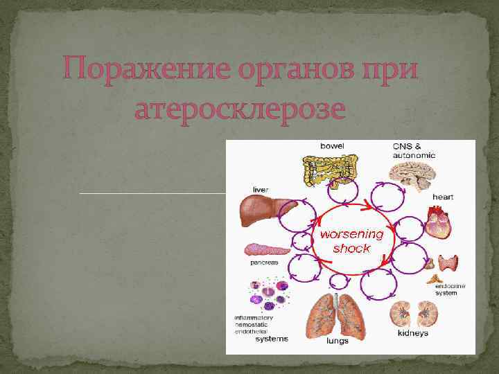 Поражение органов при атеросклерозе 