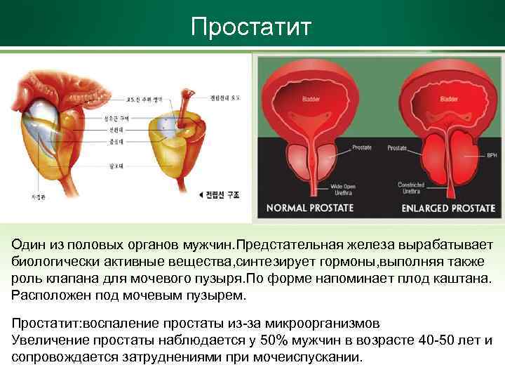 Простатит Один из половых органов мужчин. Предстательная железа вырабатывает биологически активные вещества, синтезирует гормоны,