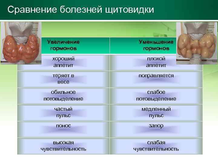 Сравнение болезней щитовидки Увеличение гормонов Уменьшение гормонов хороший аппетит плохой аппетит теряет в весе