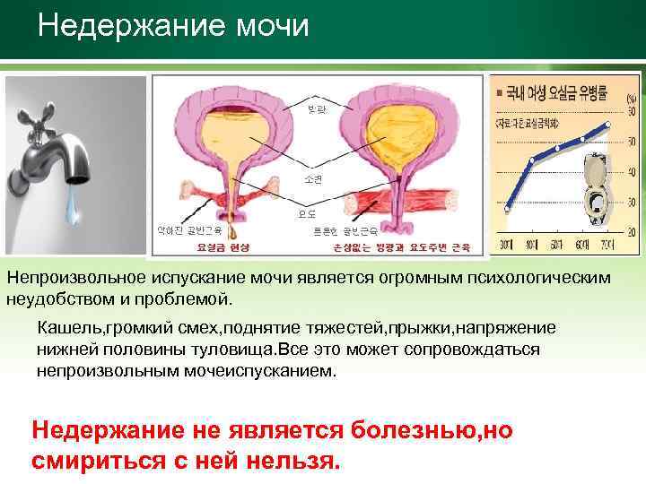 Недержание мочи Непроизвольное испускание мочи является огромным психологическим неудобством и проблемой. Кашель, громкий смех,