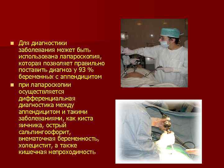 Для диагностики заболевания может быть использована лапароскопия, которая позволяет правильно поставить диагноз у 93