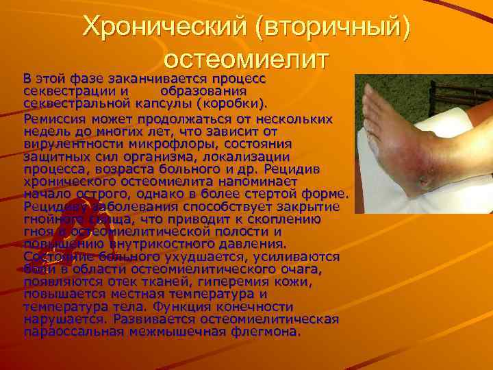 Хронический (вторичный) остеомиелит В этой фазе заканчивается процесс секвестрации и образования секвестральной капсулы (коробки).