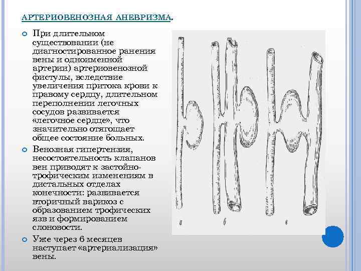 АРТЕРИОВЕНОЗНАЯ АНЕВРИЗМА. При длительном существовании (не диагностированное ранения вены и одноименной артерии) артериовенозной фистулы,