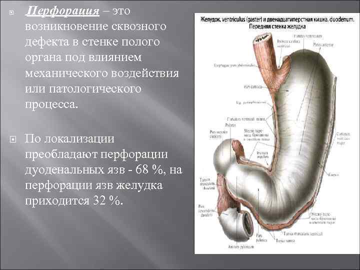  Перфорация – это возникновение сквозного дефекта в стенке полого органа под влиянием механического