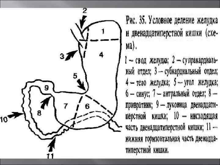 Аппендицит презентация госпитальная хирургия