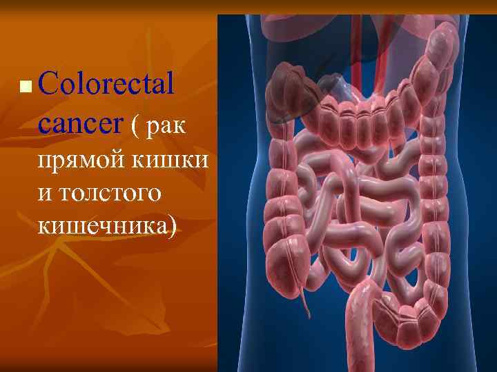 n Colorectal cancer ( рак прямой кишки и толстого кишечника) 