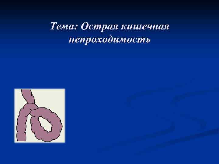 Тема: Острая кишечная непроходимость 