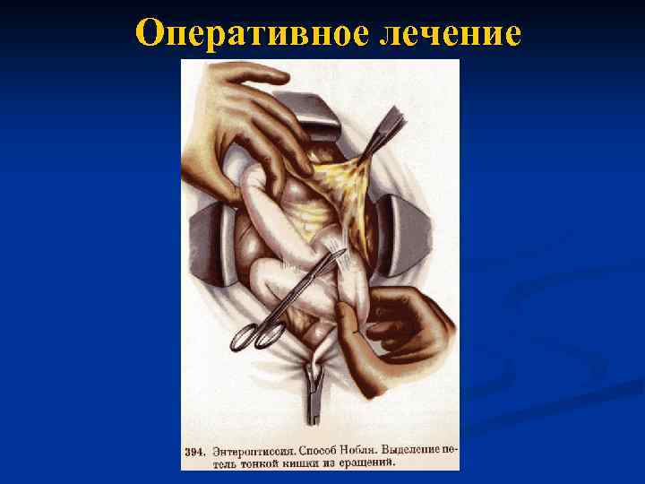 Оперативное лечение 
