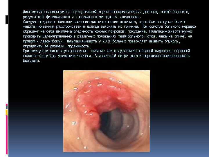 Диагностика основывается на тщательной оценке анамнестических дан ных, жалоб больного, результатах физикального и специальных