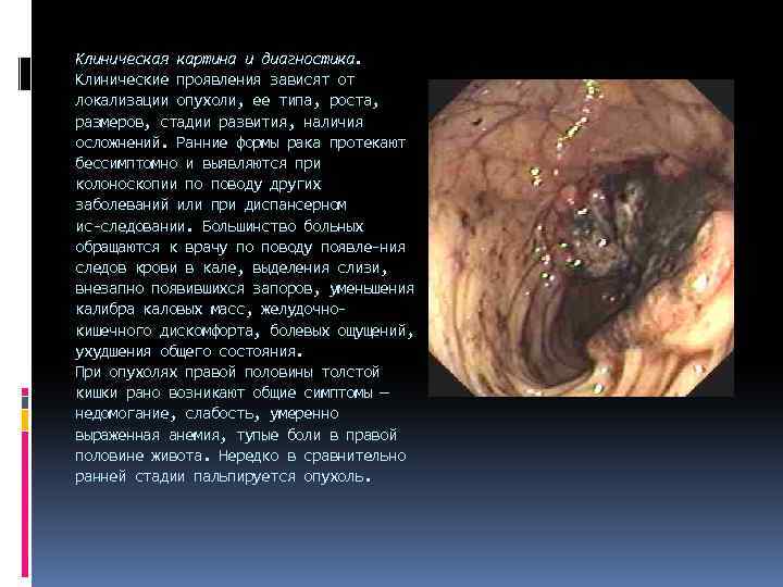 Клиническая картина и диагностика. Клинические проявления зависят от локализации опухоли, ее типа, роста, размеров,