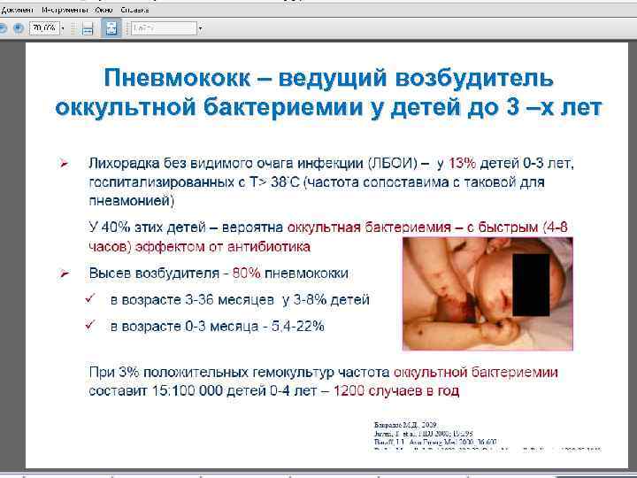 Пневмококк – ведущий возбудитель оккультной бактериемии у детей до 3 –х лет 2/17/2018 