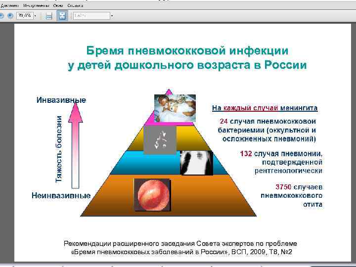 Бремя пневмококковой инфекции у детей дошкольного возраста в России Рекомендации расширенного заседания Совета экспертов