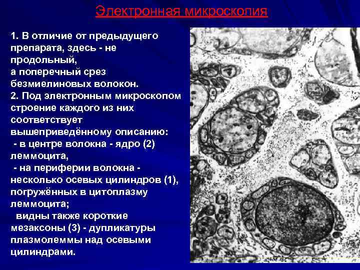 Электронная микроскопия 1. В отличие от предыдущего препарата, здесь - не продольный, а поперечный