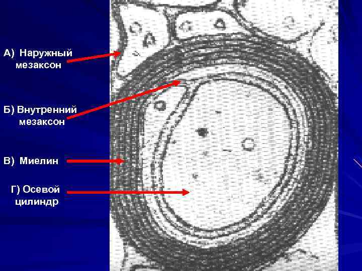 А) Наружный мезаксон Б) Внутренний мезаксон В) Миелин Г) Осевой цилиндр 