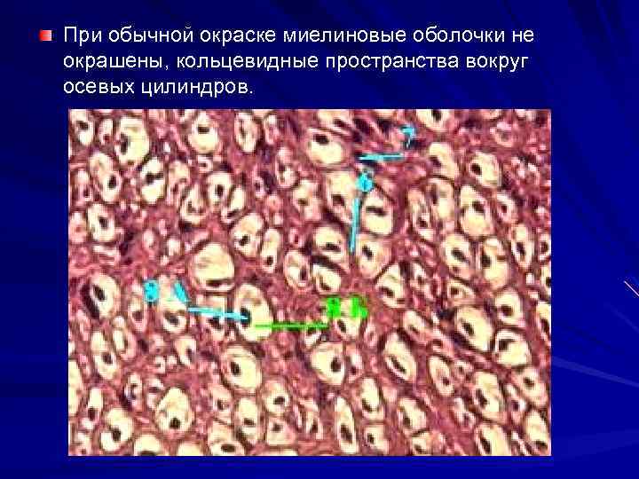 При обычной окраске миелиновые оболочки не окрашены, кольцевидные пространства вокруг осевых цилиндров. 