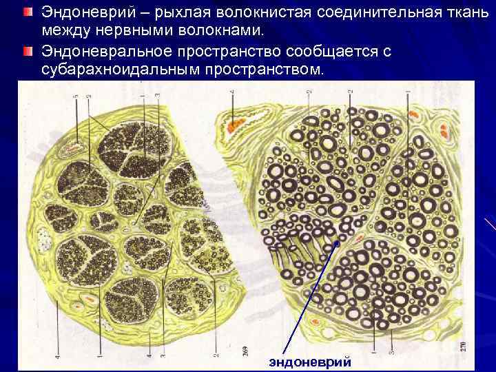 Эндоневрий – рыхлая волокнистая соединительная ткань между нервными волокнами. Эндоневральное пространство сообщается с субарахноидальным