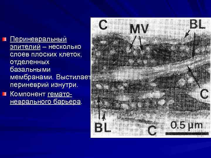 Периневральный эпителий – несколько слоев плоских клеток, отделенных базальными мембранами. Выстилает периневрий изнутри. Компонент