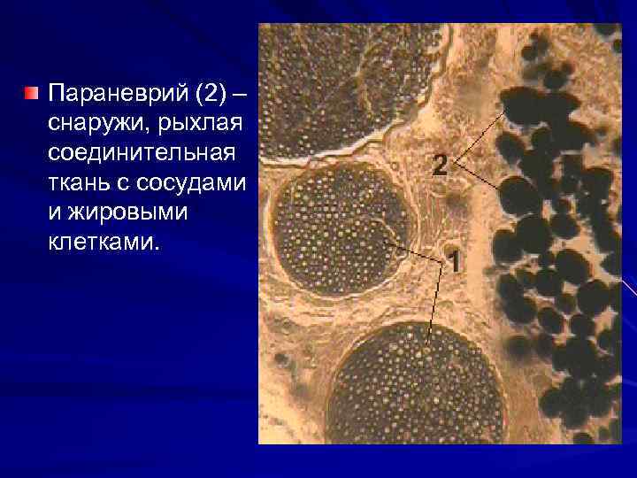 Параневрий (2) – снаружи, рыхлая соединительная ткань с сосудами и жировыми клетками. 