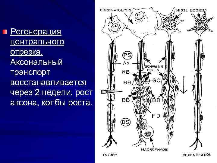 Регенерация центрального отрезка. Аксональный транспорт восстанавливается через 2 недели, рост аксона, колбы роста. 