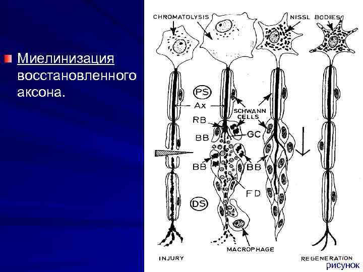 Миелинизация восстановленного аксона. рисунок 