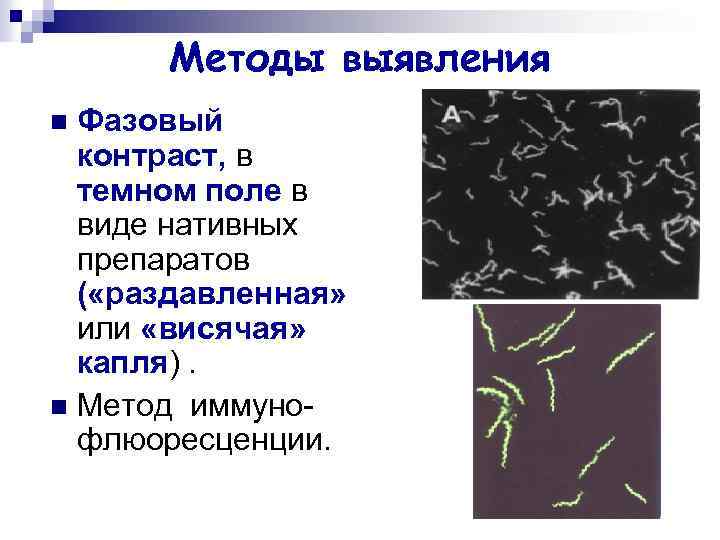 Методы выявления Фазовый контраст, в темном поле в виде нативных препаратов ( «раздавленная» или