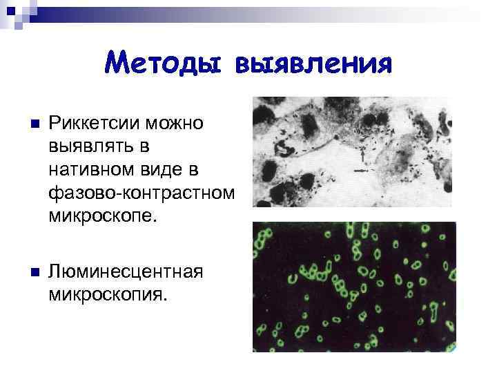 Методы выявления n Риккетсии можно выявлять в нативном виде в фазово-контрастном микроскопе. n Люминесцентная