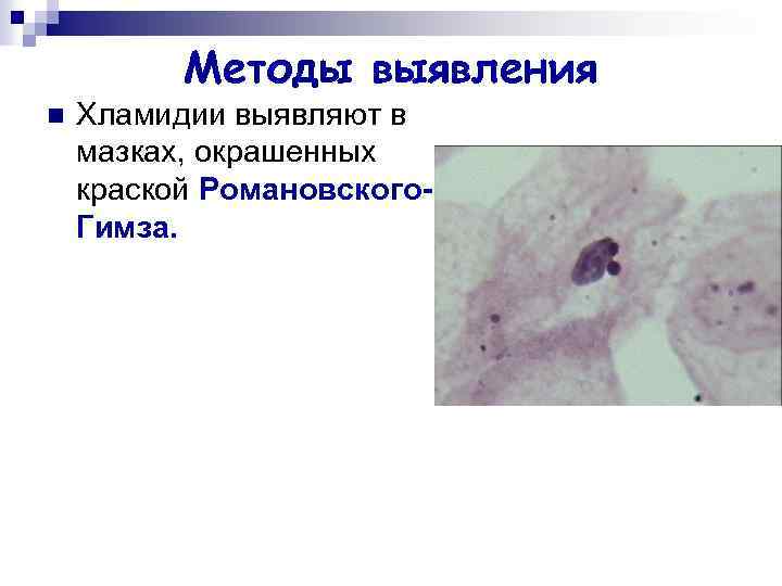 Методы выявления n Хламидии выявляют в мазках, окрашенных краской Романовского. Гимза. 