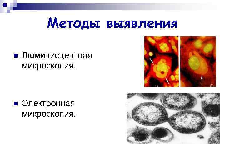 Методы выявления n Люминисцентная микроскопия. n Электронная микроскопия. 