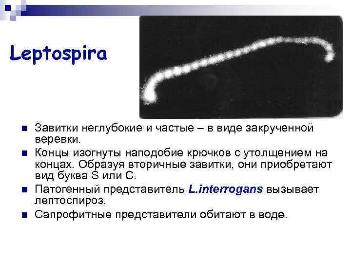 Leptospira n n Завитки неглубокие и частые – в виде закрученной веревки. Концы изогнуты