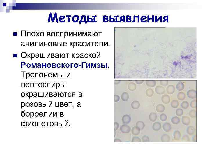 Методы выявления n n Плохо воспринимают анилиновые красители. Окрашивают краской Романовского-Гимзы. Трепонемы и лептоспиры