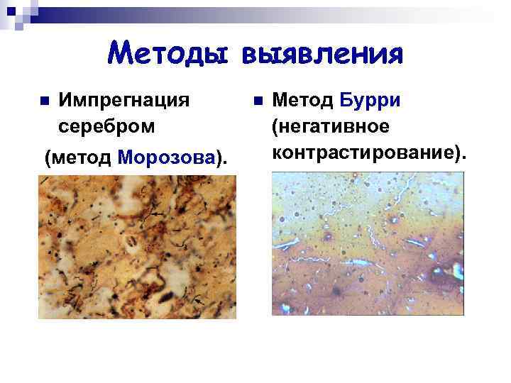 Методы выявления n Импрегнация серебром (метод Морозова). n Метод Бурри (негативное контрастирование). 