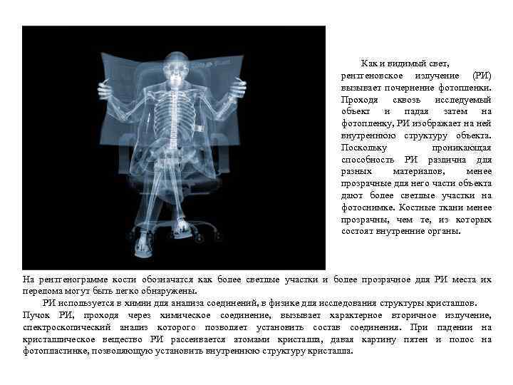 Как и видимый свет, рентгеновское излучение (РИ) вызывает почернение фотопленки. Проходя сквозь исследуемый объект