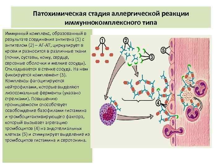 Патохимическая стадия аллергической реакции иммуннокомплексного типа Иммунный комплекс, образованный в результате соединения антигена (1)