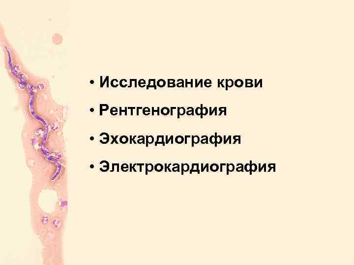  • Исследование крови • Рентгенография • Эхокардиография • Электрокардиография 