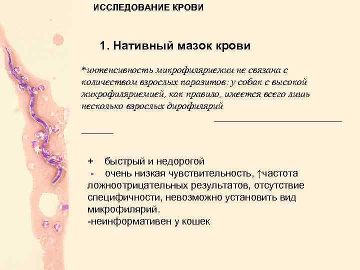 ИССЛЕДОВАНИЕ КРОВИ 1. Нативный мазок крови *интенсивность микрофиляриемии не связана с количеством взрослых паразитов: