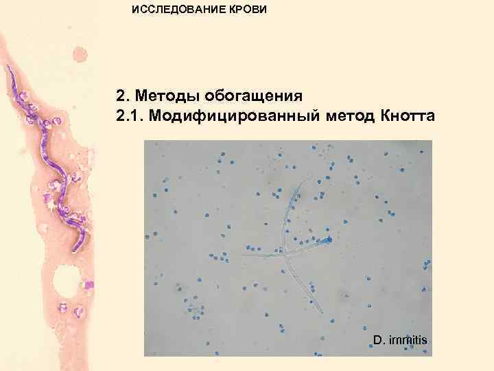 ИССЛЕДОВАНИЕ КРОВИ 2. Методы обогащения 2. 1. Модифицированный метод Кнотта D. immitis 