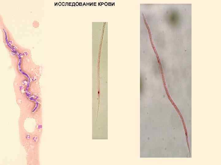 ИССЛЕДОВАНИЕ КРОВИ 