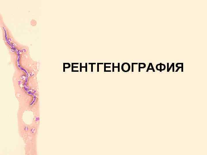 РЕНТГЕНОГРАФИЯ 