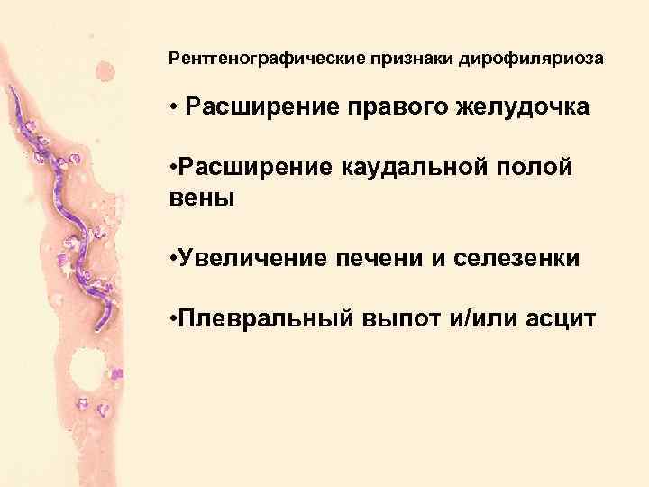 Рентгенографические признаки дирофиляриоза • Расширение правого желудочка • Расширение каудальной полой вены • Увеличение