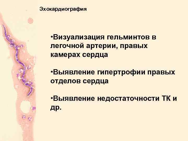 Эхокардиография • Визуализация гельминтов в легочной артерии, правых камерах сердца • Выявление гипертрофии правых